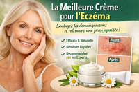 Meilleure crème pour l’eczéma : comment choisir ? (peau sèche & sensible)