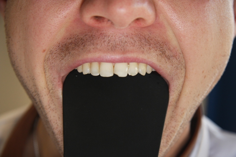 PALATAL SILICONE CONTRASTORS